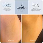 SmoothSkin Pure Adapt IPL Hair Removal Device