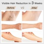BoSidin IPL Laser Hair Removal Device with Cooling