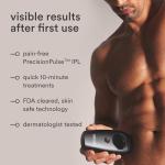 Nood Flasher 2.0 IPL Hair Removal Device