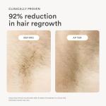 Nood Flasher 2.0 IPL Hair Removal Device