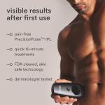 Nood Flasher 2.0 IPL Hair Removal Device