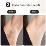 JOVS IPL Laser Hair Removal Device for All Skin
