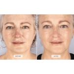 LED Light Therapy Face Mask for Anti-Aging