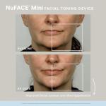 NuFACE MINI White Starter Kit