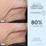 NuFACE Trinity Microcurrent Facial Device & Gel