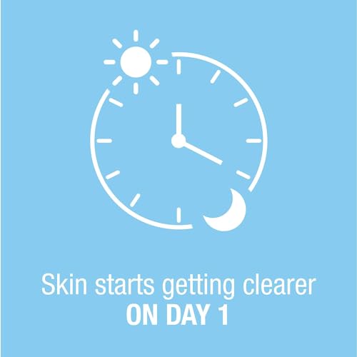 Neutrogena On-The-Spot Acne Treatment - Gentle Pimple Gel