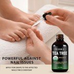Tea Tree Essential Oil by Fiora Naturals - 100% Pure Organic Oil, for Face, Hair, Skin, Acne, Scalp, Foot and Toenails, Melaleuca Alternifolia