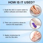 Foot Pumice Stone 4 Pack Pedicure Stone for Feet Pumice Sponge for Feet Callus Remover and Scrubber Double Sided Pedicure Foot Pumice Stone for Feet and Heels Callus and Dead Skins (Purple)