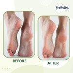Footvital Pumice Stone for Feet, Foot Exfoliator Scrubber, Callus Remover, Made of Natural Terra-Cotta, Exfoliates & Smooths Rough Skin