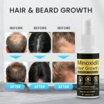 Luxury Hair Growth Treatment Spray - 3 Pack