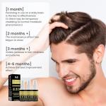 Luxury Hair Growth Treatment Spray - 3 Pack