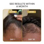 Shedavi Iconic Vegan Hair Growth Serum
