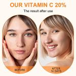 Luxury Vitamin C Serum with Hyaluronic Acid & Retinol