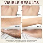 Cyperus Rotundus Oil for Smooth Skin