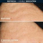 Glow Gel Cleanser with Vitamin C and Glycolic Acid