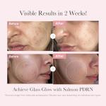 Salmon DNA Skincare Mini Set for Hydration