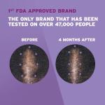 Luxury Hair Regrowth Foam for Women, 2-Month Supply