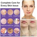 Luxury Skincare Set for Women and Teens