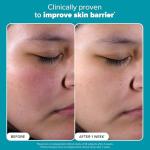 Paula's Choice 2% BHA Exfoliant Travel Size