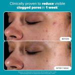 Paula's Choice 2% BHA Exfoliant Travel Size