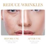 Collagen Anti-Aging Skin Care Set for Women