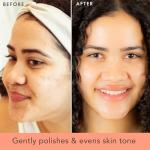 Vegan Microdermabrasion Scrub for All Skin Types