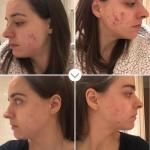 Pai Skincare - Organic Instant Kalmer Sea Aster + Schisandra Ceramide Serum | Natural, Vegan, Sensitive Skincare (1 fl oz | 30 mL)