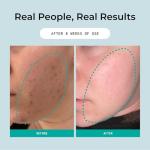 Gentle Overnight Exfoliator with Vitamin C