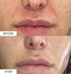 In Your Face Bakuchiol Wonder Serum – Hydrating Anti-Aging Bakuchiol Serum with CoQ10, Ceramides & Purslane – Retinol Alternative Anti-Wrinkle Skin Care – Vegan & Gentle for Sensitive Skin – 1 oz