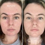 PAI SKINCARE - Organic Carbon Star Detoxifying Overnight Face Oil | Natural, Vegan, Sensitive Skincare (1 fl oz | 30 ml)