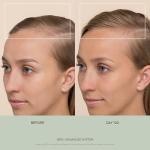 VEGAMOUR GRO+ Advanced Balancing Shampoo | Lightly Exfoliates, Cleanses and Removes Buildup Without Stripping | For Severe Signs of Thinning | Color Safe, Vegan, Cruelty-Free (8 Fl Oz)