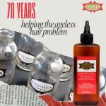 ENDOTEN CONTROL Lotion 200 ml - 90 Days Challenge for Stronger, Healty and shiny hair. Gingseng and Amino Acids with Protein complex. Vegan hair care. Capilar Lotion. Natural hair growth.