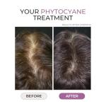 PHYTOCYANE Anti-Hair Thinning Dietary Supplement (12-Week Supply), 84 Count (Pack of 1),1 cap per day, Vegan, Lactose-Free, Gluten-Free, No Preservatives