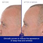 Augustinus Bader Vegan Retinol Anti-Aging Serum 30 ml