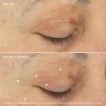 Retinol-Alternative Duo: Night Cream & Eye Cream Set