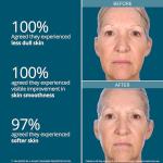 45-Day Vegan Face Transformation Program