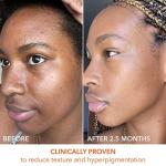 Dr. Dennis Gross Daily Peel for Glowing Skin