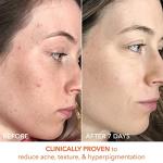 Dr. Dennis Gross Daily Peel for Glowing Skin