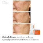 Dr. Dennis Gross Collagen Boosting LED Mask Kit