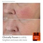 Dr. Dennis Gross Collagen Boosting LED Mask Kit