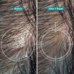 Vegan Anti-Dandruff Shampoo with Tea Tree Oil