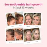 Vegan Hair Growth Shampoo with Aloe & Turmeric