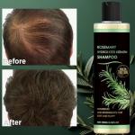 Rosemary Biotin Shampoo for Hair Growth - Sulfate-Free Volumizing Shampoo for Thinning Hair, Dry & Damaged Hair - Vegan, Color Safe with Keratin - Men & Women (1)