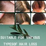 Rosemary Biotin Shampoo for Hair Growth - Sulfate-Free Volumizing Shampoo for Thinning Hair, Dry & Damaged Hair - Vegan, Color Safe with Keratin - Men & Women (1)