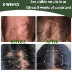 Rosemary Biotin Shampoo for Hair Growth - Sulfate-Free Volumizing Shampoo for Thinning Hair, Dry & Damaged Hair - Vegan, Color Safe with Keratin - Men & Women (1)