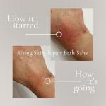 Westlab Skin Repair Bath Salt 900g - For Sensitive Skin