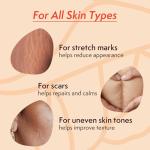 Nature Spell Stretch Mark Body Oil, 100ml