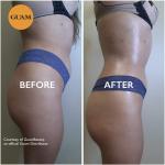 GUAM Seaweed Anti-Cellulite Body Treatment Mask