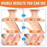 Wart and Skin Tag Remover Cream 20g