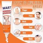 Wart and Skin Tag Remover Cream 20g